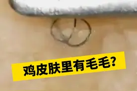 皮肤摸起来疙疙瘩瘩，医生教你这样处理#鸡皮肤 #毛周角化症 #皮肤问题 #疙瘩 #夏天视频封面