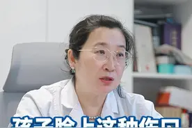 孩子脸上有伤口，一旦留疤，影响的是一生的颜值！家长一定要重视起来！#科普#留疤#宝妈#摔伤擦伤#皮肤损伤怎么办视频封面