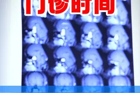 库欣综合征  应该怎么办呢？ #库欣综合征 #肢端肥大症 #医疗创作者培优计划 #垂体瘤 #李士其视频封面