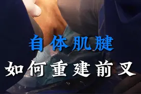自体肌腱如何重建前叉韧带？ #前交叉韧带重建 #自体肌腱 #手术室日常 #硬核健康科普行动 #年度健康知识干货大赏视频封面