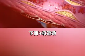 血管狭窄患者 建议常做以下4种运动！ #血管狭窄 #下肢血管狭窄 #下肢血管堵塞 #下肢动脉硬化闭塞症#硬核健康科普行动视频封面