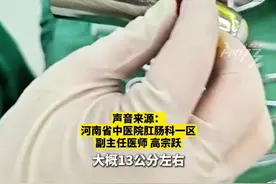 惊！男子蹲坑2小时肠子掉出13厘米。蹲坑玩手机的习惯太危险，医生：蹲超10分钟，风险直线上升。#脱肛  #肛肠科