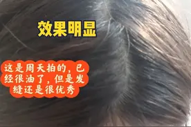 有没有练的家人来说说！#八段锦 真的有用吗！#秃头 #神奇视频封面