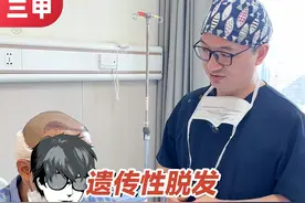 遗传性脱发，单靠植发可不行 #脱发 #植发 #脱发怎么办 #江华医生团队视频封面