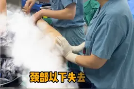 打球导致高位截瘫颈部以下失去知觉 全麻手术风险很大 冒着风险采用局麻进行药物泵植入#高位截瘫 #神经外科 #门诊案例 #医路前行视频封面