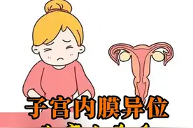 子宫内膜异位 生育杀手之一 痛经占比也非常高#医学科普 #子宫内膜异位症 #痛经 #关爱女性健康视频封面