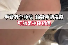 触碰手臂的肿块，手指发麻，你知道是什么疾病吗？ #肿瘤专家王春萌 #抖出健康知识宝藏  #医疗健康创作训练营 #神经鞘瘤 #肿块视频封面