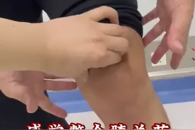 踢球后膝关节肿胀疼痛，到底咋回事 #医学科普 #膝关节疼痛 #运动损伤视频封面