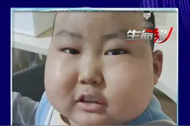 5年化疗17次，那个乐观开朗的小男孩豪豪出院了！#白血病 #brtv生命缘视频封面