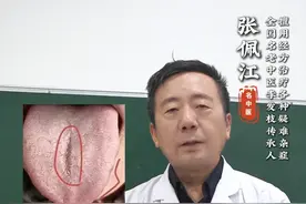 这种舌头，不要再用参苓白术散，多花钱是小，耽误病情是大 #中医舌诊 #科普健康知识 #调理