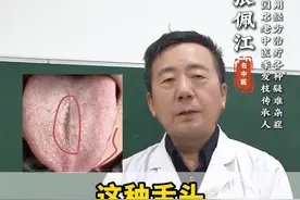 这种舌头，不要再用参苓白术散，多花钱是小，耽误病情是大 #中医舌诊 #科普健康知识 #调理