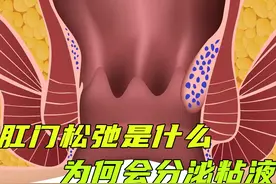 你知道什么是肛门松弛吗？为什么肛门也会分泌粘液？