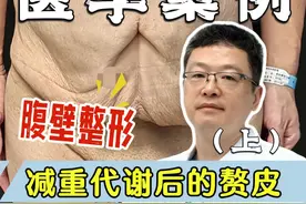 减重代谢后的赘皮(上)，难以启齿的自卑 #腹壁整形 #腹壁成型 #八大处金骥 #减重后赘皮 #案例讲解视频封面