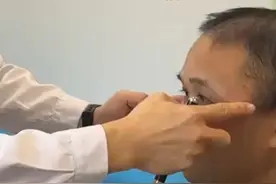 颅骨缺损不可怕，幸运的是可以进行颅骨修补手术，但参与交通一定做好“一盔一带”确保自身安全#交通安全 #颅骨缺损 #脑出血 #硬核健康科普行动视频封面