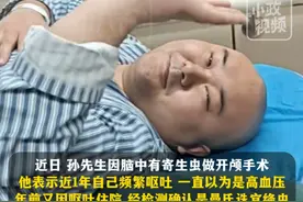 2月19日（发布），河南郑州。男子脑内查出4条寄生虫，“可能因为吃牛蛙火锅没煮熟”，目前做开颅手术取出了1条。关注👉@小政视频 #河南dou知道 #开颅手术 #脑内寄生虫 #牛蛙火锅 （来源：@潮新闻  B站：神经外科贺晓生教授 大象新闻 小红书：609921702）视频封面