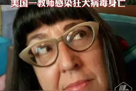 小心野生动物！美国一教师救蝙蝠被咬后，感染狂犬病毒身亡视频封面