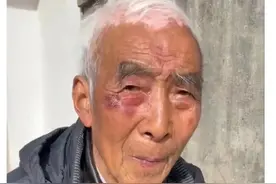 外公您在哪儿？泰州靖江八旬老人走失，穿蓝色上衣，高1米65图片