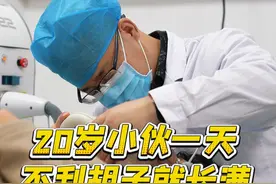 20岁小伙一天不刮胡子就长满，激光去络腮胡 #医学科普 #激光脱毛 #络腮胡视频封面