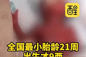 全国最小胎龄21周出生才9两奇迹宝宝 在深圳出院了 （编辑：锦玥）#广东dou知道 #宝妈  #家长必读 #早产儿  #热点新闻事件  全国最小胎龄早产儿出院视频封面