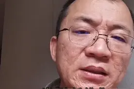 25岁肺纤维化，还年轻不要悲观着急，更不要瞎百度吓自己 #肺纤维化 #慢阻肺 #抖出健康知识宝藏 #开工去班味健康指南视频封面