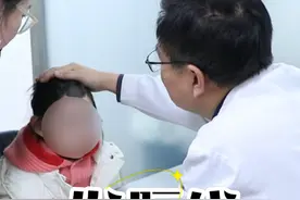 头顶黑痣 #黑痣 #头顶黑痣 #黑痣凸起来正常吗 #抖出健康知识宝藏  #医者