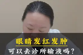 眼睛发红发肿，可以直接去诊所输液吗？#眼科医生曲进锋 #医学科普 @抖音短视频视频封面