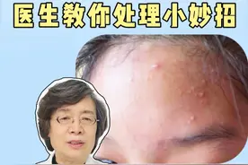 额头上长疙疙瘩瘩的闭口粉刺，很影响美观，今天皮肤科医生教你3步正确处理法#医学科普 #科普 #闭口 #痘痘 #变美视频封面