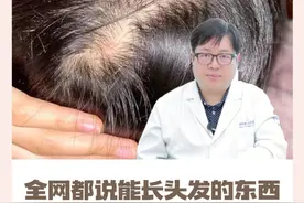 这个全网都在说能长头发的东西，90%的人都用错了! #头发 #掉发 #科普 #硬核健康科普行动 #冷知识视频封面