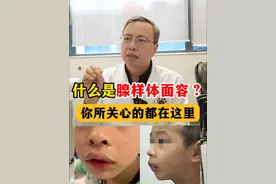 什么是腺样体面容？你所关心的都在这里 #硬核健康科普行动 #腺样体肥大 ##医疗健康创作训练营 #腺样体面容视频封面
