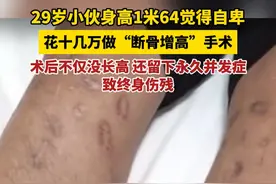 29岁小伙身高1米64觉得自卑，花十几万做“断骨增高”手术，术后不仅没长高，还成了终身伤残……提醒：为健康人做“断骨增高”属违法行为！请勿尝试！视频封面