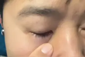 奥运冠军李越宏自曝，到印度比赛第一天细菌感染，还有队友上吐下泻。#河南dou知道 #万万想不到 #印度 #细菌感染 #社会百态视频封面