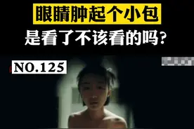 眼睑周围肿起小包，真的是因为看了不该看的吗？#科普 #针眼麦粒肿 #医学科普 视频封面