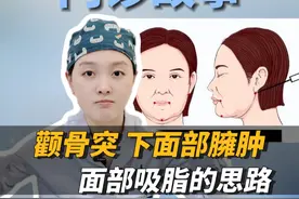 颧弓突出，面部臃肿，面吸的改善思路是什么？ #面吸#面吸黄金微雕#射频紧肤#八大处张心瑜#面吸 #面吸黄金微雕 #面部吸脂 #射频紧肤 #八大处张心瑜视频封面