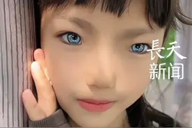 8岁女孩异瞳双眼成蓝色，五、六个月时眼睛慢慢变蓝 #蓝眼睛的女孩 #瓦登伯格综合征