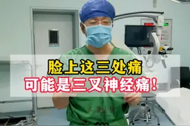 三叉神经痛，都是哪里痛？ #三叉神经痛 #脸疼 #牙疼 #天下第一痛视频封面