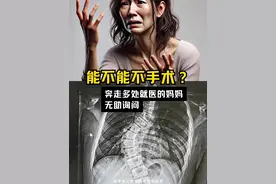 医生能不能不手术？13岁的孩子被确诊脊柱侧弯，声音太无助！ 这个妈妈为了孩子奔走了多个医院，说侧弯在40度以上，希望能通过保守治疗，不想手术，来连线我。这个案例非常有代表性，通过真实故事给大家分享下中度脊柱侧弯实际生活中的处理方法#脊柱侧弯 #罗义医生 #健康科普为人民 #医学科普 #科学高光故事集视频封面