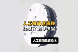 人工椎间盘置换，你又了解多少呢？#人工椎间盘 #椎间盘置换 #腰椎 #颈椎 #健康守护计划 @宁宇视频封面