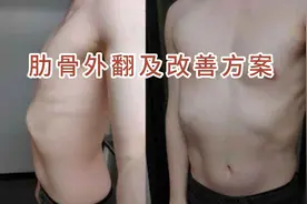 肋骨外翻及改善方案。肋骨外翻不仅影响人的美观视频封面