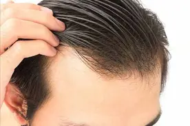 人能活多久看头发就能知道？医生：寿命长的人图片