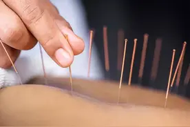 门13针针针扎鬼穴，是千年秘书，号称胆与阎王抢人图片