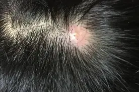 头皮老是长疙瘩和脓包，或是这3种病在求救，并非排毒，别...图片