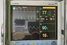 结肠癌切除手术后，那教授说很成功，周围也未见异常。...图片