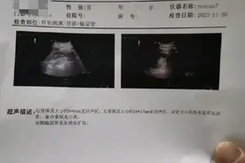 肾上的囊肿会无故消失吗图片