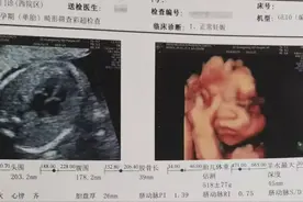 深圳剖腹产婴儿窒息死亡，医院回应 记者 最近图片