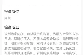 复查必须去原来的医院吗?# #分享复查经历图片