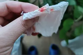 我的心脏支架手术第20天：忙碌起来，让我忘记病痛图片