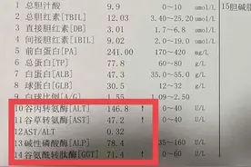 肝功能报告中的“4个酶“身世大揭秘！图片