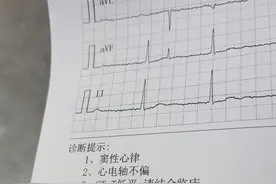 今天我终于把带了十多年的宫内节育器从我的身体里面拿掉了...图片