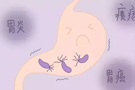 幽门螺杆菌感染，请记住这10个中成药图片