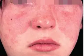 婚礼前夕突然高烧，未婚夫和未来婆婆得知后，我每天以泪洗面图片
